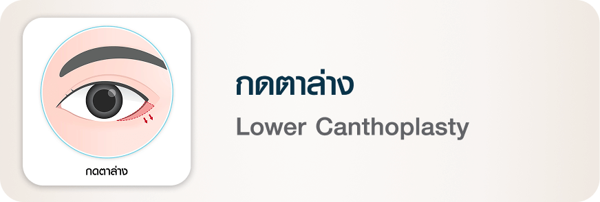 ศัลยกรรมตา กดตาล่าง Lower Canthoplasty บีพราวด์ คลินิก