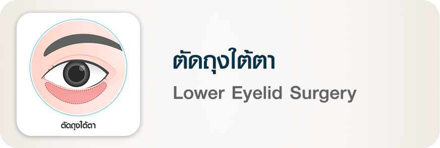 ศัลยกรรมตา ตัดถุงใต้ตา Lower Eyelid Surgery บีพราวด์ คลินิก