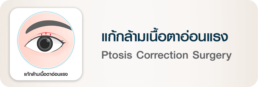 ศัลยกรรมตา แก้กล้ามเนื้อตาอ่อนแรง Ptosis Correction Surgery บีพราวด์ คลินิก
