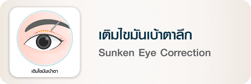 ศัลยกรรมตา เติมไขมันเบ้าตาลึก Sunken Eye Correction บีพราวด์ คลินิก