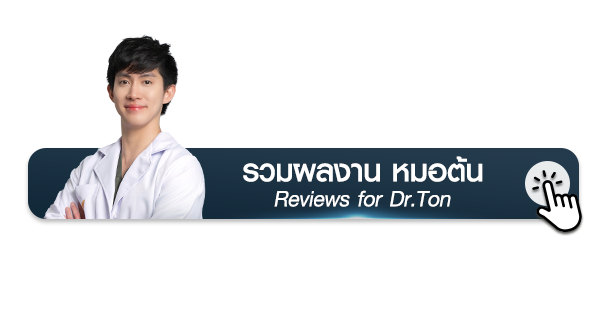 รวมภาพรีวิวเคสศัลยกรรมตา หมอต้น (จักษุแพทย์เฉพาะทาง) Reviews for Dr.Ton