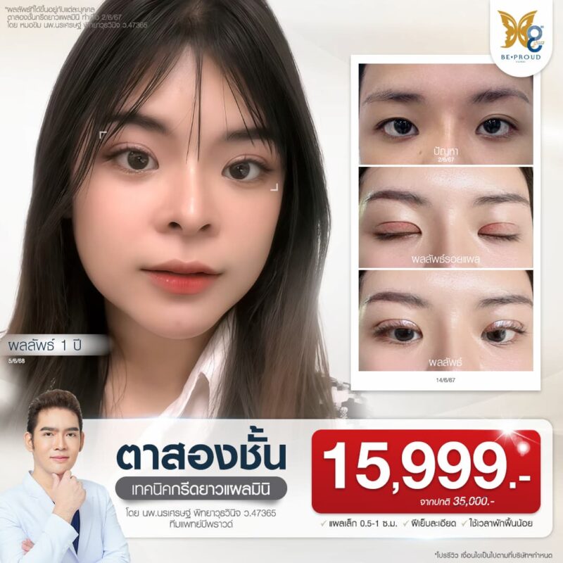 โปรโมชั่นศัลยกรรมตา หมอขิม นพ.นรเศรษฐ์ พิทยาวุธวินิจ แพทย์ผู้เชี่ยวชาญศัลยกรรมใบหน้า ปากกระจับ ตาสองชั้น เสริมจมูก เสริมคาง บีพราวด์คลินิก