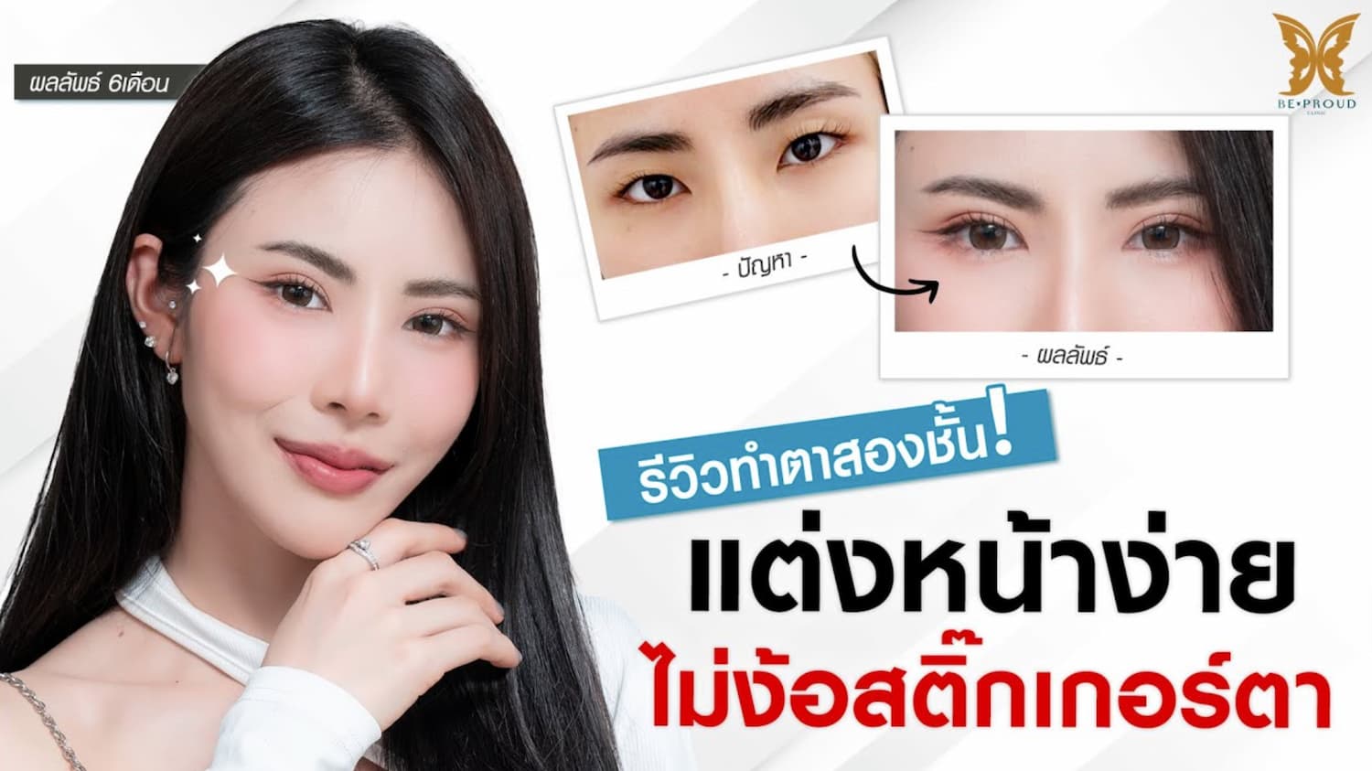 วิดีโอรีวิวความประทับใจจากผู้ใช้บริการศัลยกรรมตาบีพราวด์คลินิก Beproud Clinic Eyes