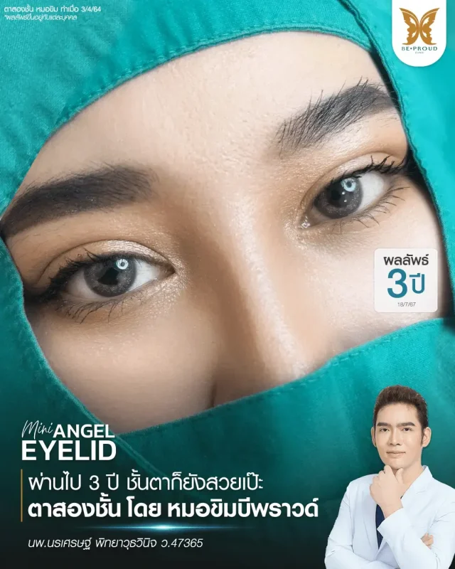 ภาพรีวิวคนสวย ตาสองชั้นกรีดยาว โดยหมอขิม (นพ.นรเศรษฐ์) บีพราวด์คลินิก แสดงผลลัพธ์ ชั้นตาสวยคมชัด ดวงตาดูสดใส