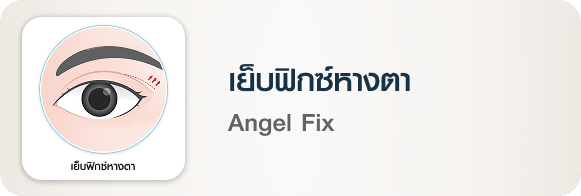เทคนิคศัลยกรรม เย็บฟิกซ์หางตา Angel Fix Beproud Clinic