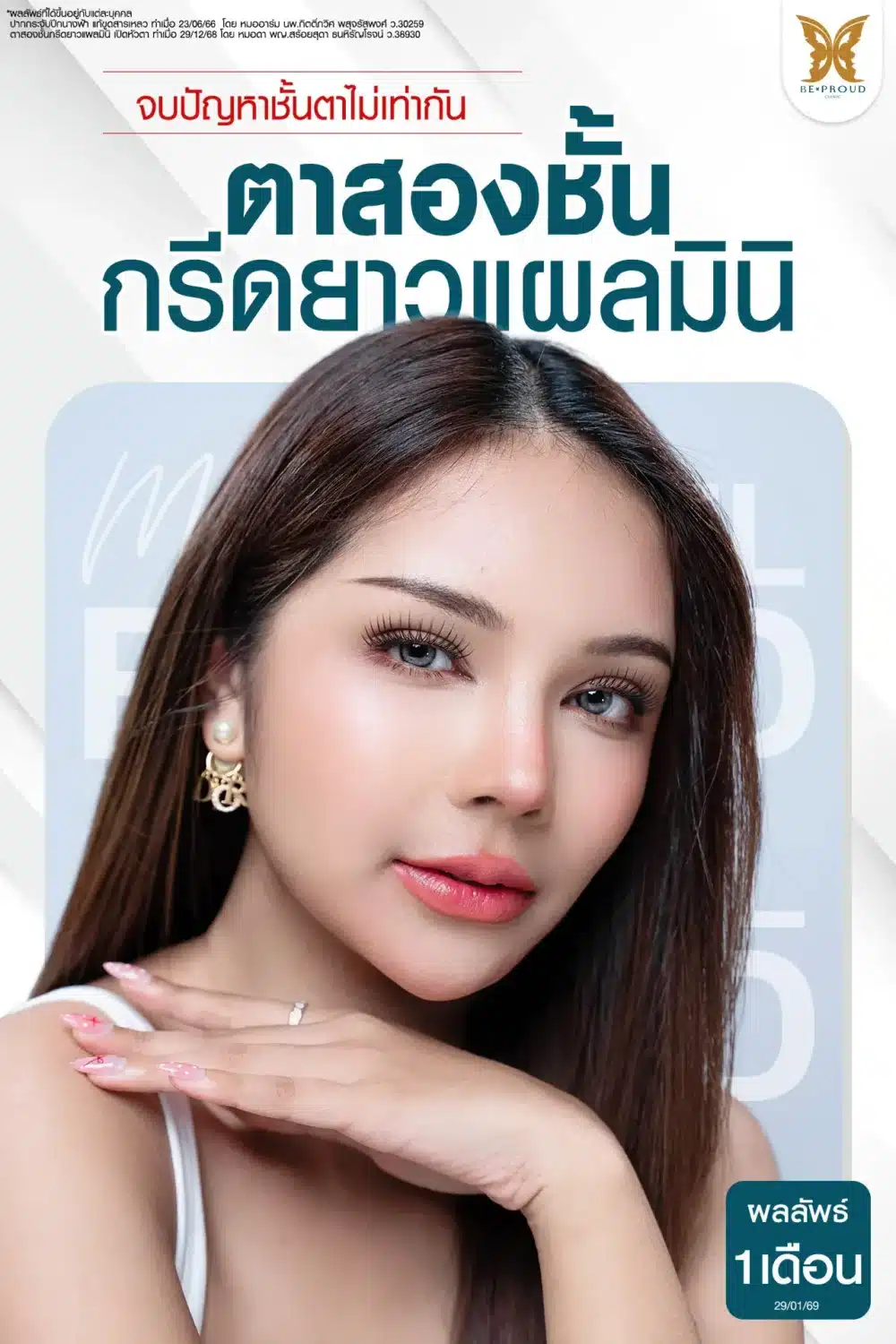 จบปัญหาตาไม่เท่ากัน! รีวิวผลลัพธ์ศัลยกรรมตาสองชั้นครบ 1 เดือน คุณพิมพ์ ที่ บีพราวด์ คลินิก ( Beproud Clinic ) เทคนิคกรีดยาวแผลมินิ สวยเป๊ะทุกมุม